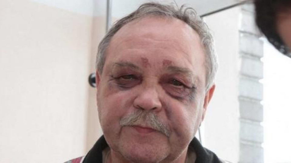 Бившият мъж на Мими Иванова жертва на жесток побой (Юрек Рибински бил между живота и смъртта) Бившият мъж на Мими Иванова жертва на жесток побой (Юрек Рибински бил между живота и смъртта)