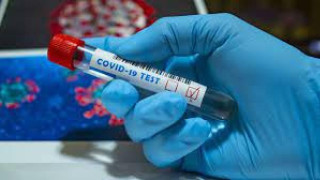 34 жертви на коронавируса през изминалите 24 часа!