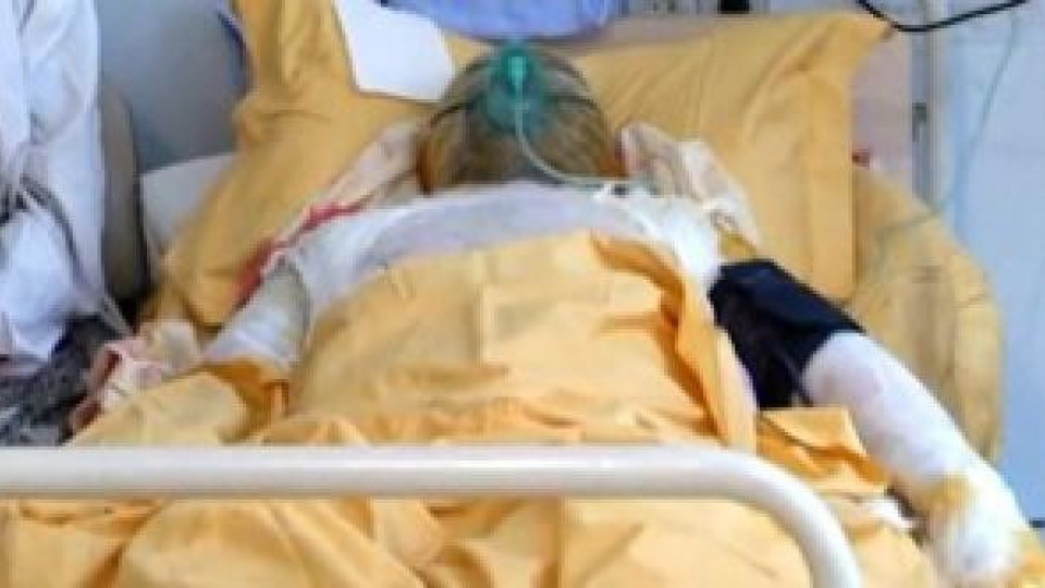 Тежко остава състоянието на самозапалилия се мъж в Бургаско Тежко остава състоянието на самозапалилия се мъж в Бургаско