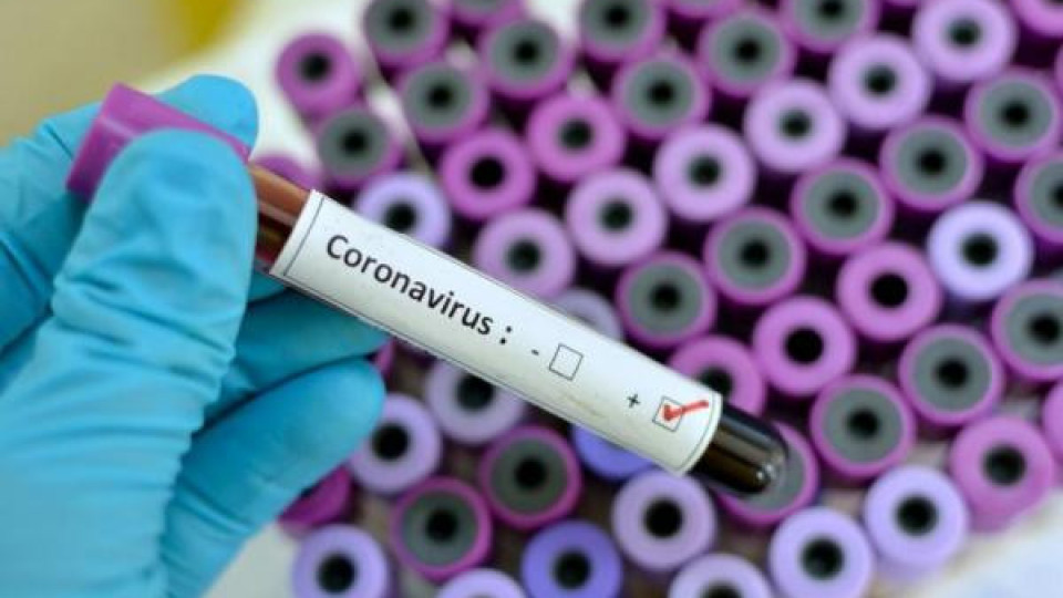 Китайски експерт: Източникът на коронавирус може да не е в Китай