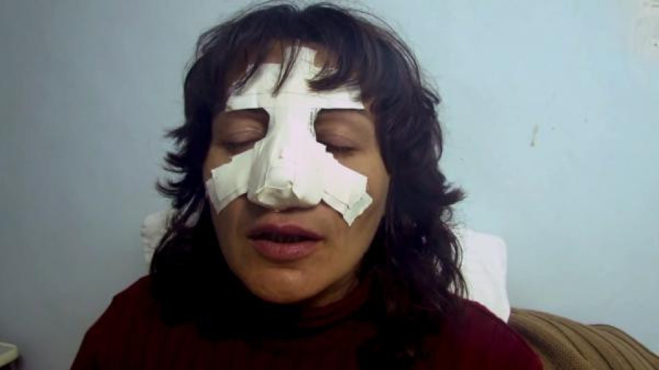 Пребиха жена в Добрич, помислили я за сирийка (ВИДЕО)