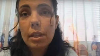 Пореден пътен инцидент с тротинетка в Плевен. Блъснаха двегодишно момченце, а мъжът, управлявал двуколесно превозно средство, е избягал от мястото на инцидента