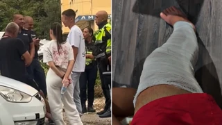 Мъж твърди, че е блъснат от автомобил в Плевен, но случаят е потулен заради полицейски връзки